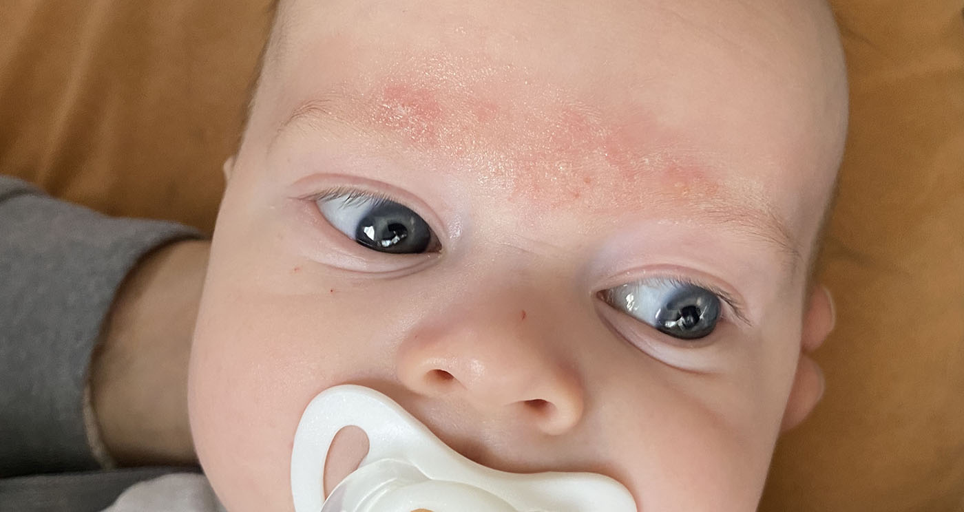 alaceum_showcase_2_1m